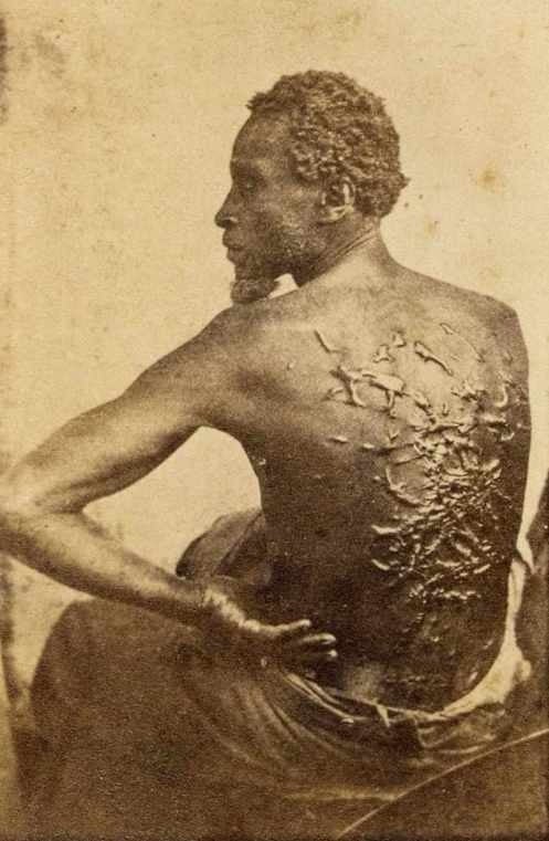gordon_scourged_back_npg_1863.jpg gordon_scourged_back_npg_1863.jpg